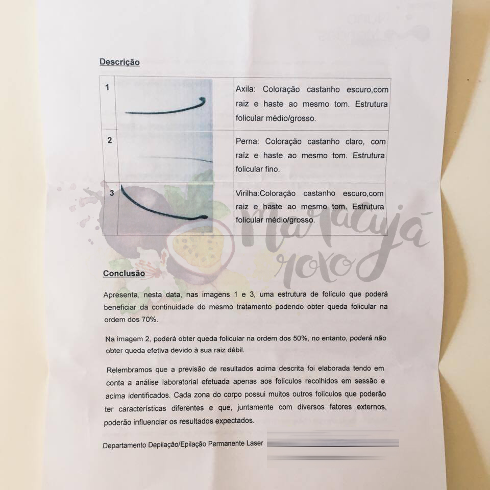 analise-pelo-depilação-a-laser-2